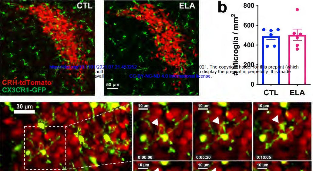 Tallie Z Baram (@z_baram) on Twitter photo SO proud <a href="/JessicaLBolton/">Dr. Jessica L. Bolton</a>! >4 yrs of passion & smarts. 4-D live imaging of microglia-neuron interaction in neonatal mice in situ! Chronic chemogenetic microglia activation in neonates sans injection stress! yes. microglia mediate ELS effect on circuit maturation SO proud <a href="/JessicaLBolton/">Dr. Jessica L. Bolton</a>! >4 yrs of passion & smarts. 4-D live imaging of microglia-neuron interaction in neonatal mice in situ! Chronic chemogenetic microglia activation in neonates sans injection stress! yes. microglia mediate ELS effect on circuit maturation