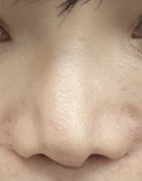 ふぐ ハリセンボン 鼻dt中 Onakaitai70 Twitter