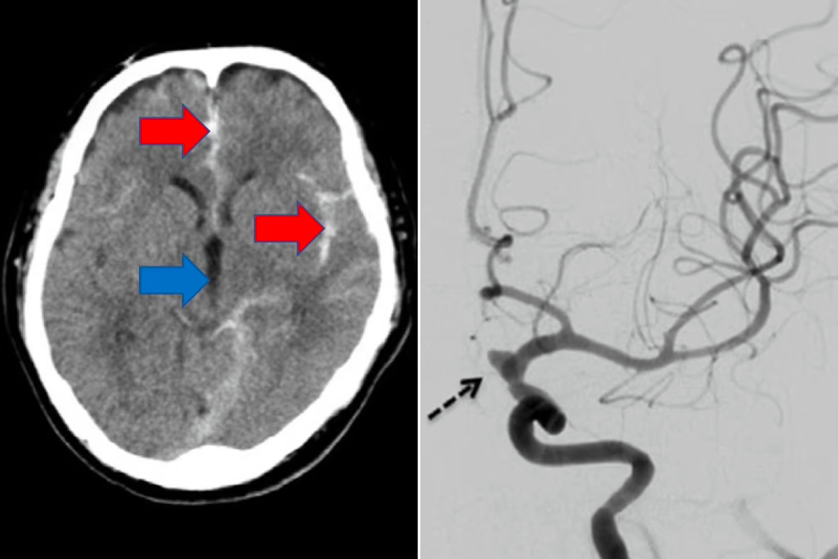 nypost's tweet image. Man almost masturbates himself to death: medical case study trib.al/GegML3v