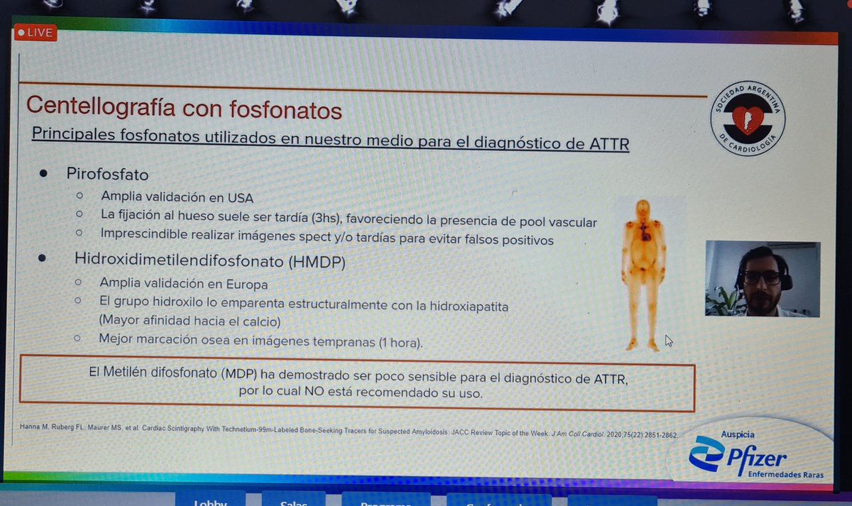 SACnuclear's tweet photo. SAC congreso #IMAGENES 
📌 #Amiloidosis La Centellografia y su excelencia como método diagnostico. 
Brillante Dr. Gustavo Daquarti 
@Daqua #Imagenes21 
@AacNuclear @ComunidadFAC 
@consejoEcoSAC @sac_hit @TomoResoSac @GeronazzoJose
@fermerani @rodridp @aleconeldo @NeivaMaciel_doc https://t.co/tuEp36ed2h