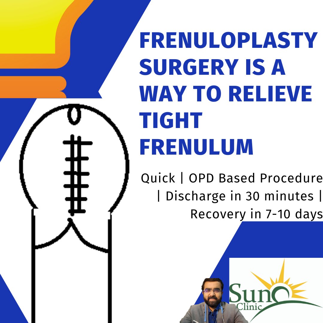 Frenuloplasty