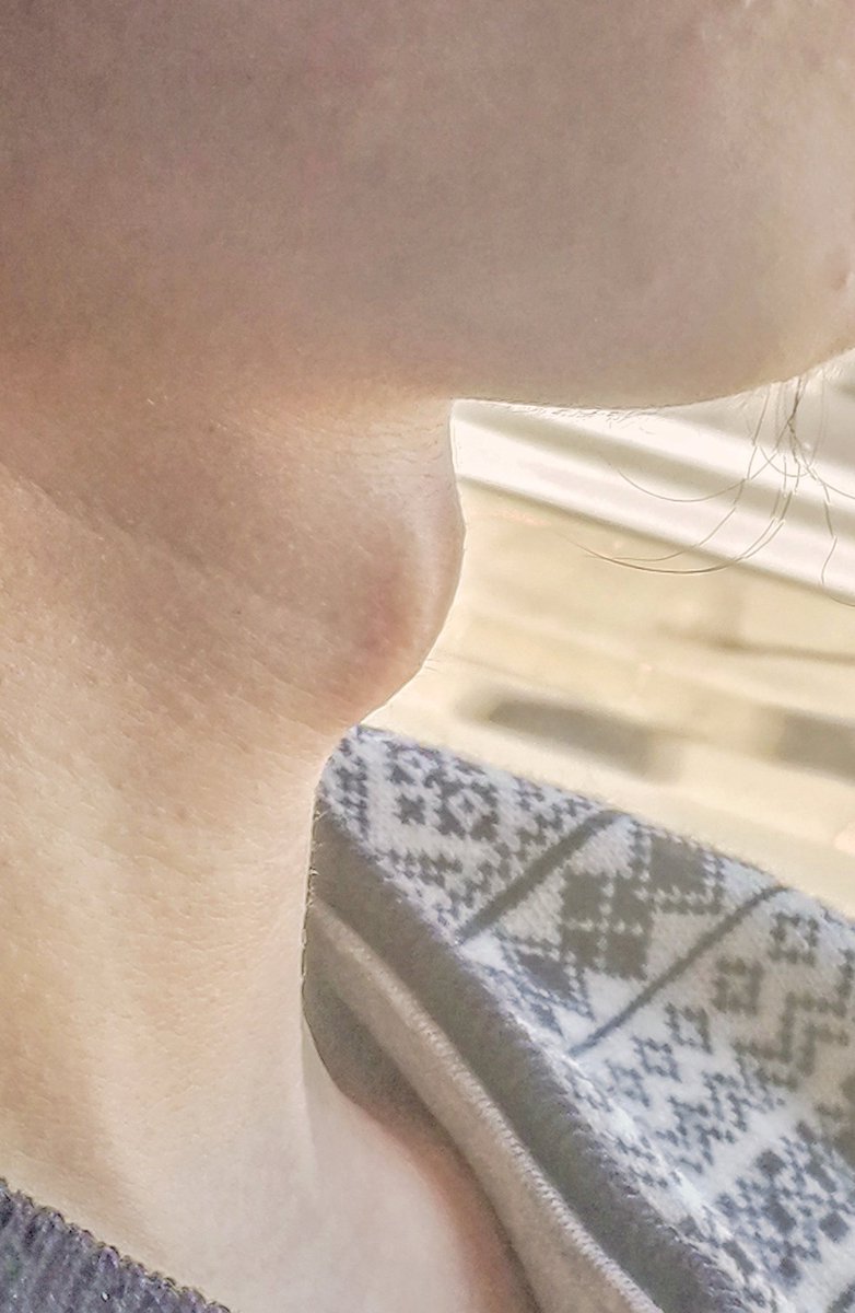 SCNU0729's tweet photo. The extremely huge adam's apple belongs to one of my friends who was born in Gansu and spent his high school time in Qinghai.
These photos were taken at November 2018. He specially slept about an hour on the bus to let me photo his neck. https://t.co/gNEKPGEDAW