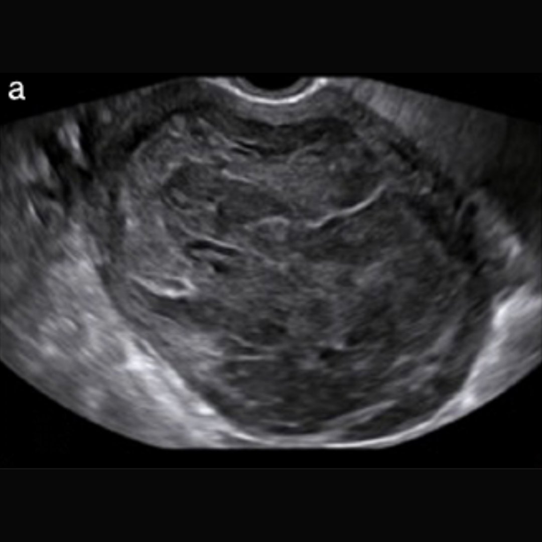 ISUOG tweet media