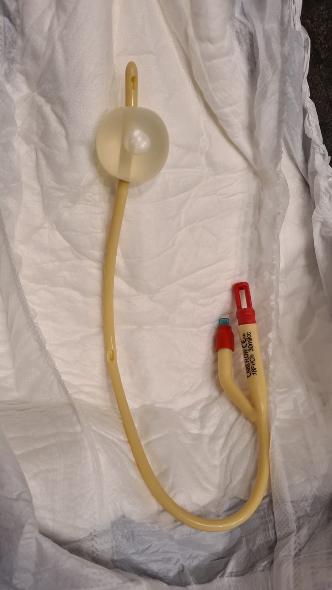 RubbaglYce's tweet photo. For those wondering what a #HoleyFoley looks like ... the hole at 3inches/10cm from the balloon and the capped end of the catheter will render you incontinent. You will not be able to hold your pee! The difference with this setup is that you will feel every drop, squirt or gush. https://t.co/0ig9iJI8oq