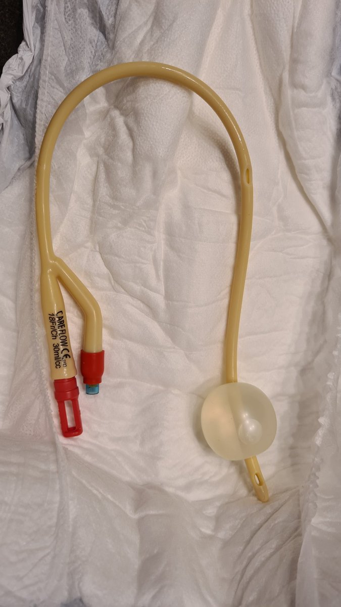 RubbaglYce's tweet photo. For those wondering what a #HoleyFoley looks like ... the hole at 3inches/10cm from the balloon and the capped end of the catheter will render you incontinent. You will not be able to hold your pee! The difference with this setup is that you will feel every drop, squirt or gush. https://t.co/0ig9iJI8oq