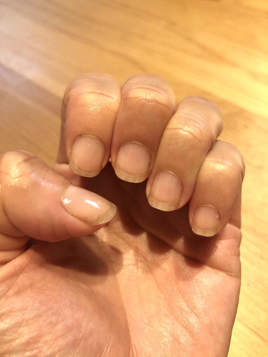 まぅ 深爪治したい Mt Mayu Twitter