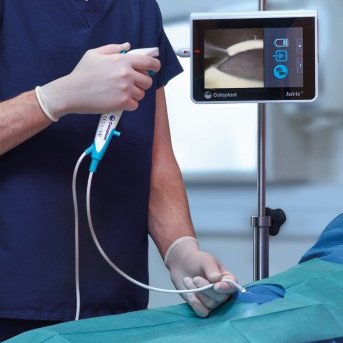 CP_Endourology's tweet photo. 🚨Alert: ureteral stents removal procedures time can be optimized!
Steps involving time and resources can be omitted¹ by using our stent removal solution #Isiris allowing a better time management² ³ ⁴ ⁵ https://t.co/Yk0AWISkEJ
👉Find out more on https://t.co/Hijin0idiK https://t.co/1knSIyKk6A