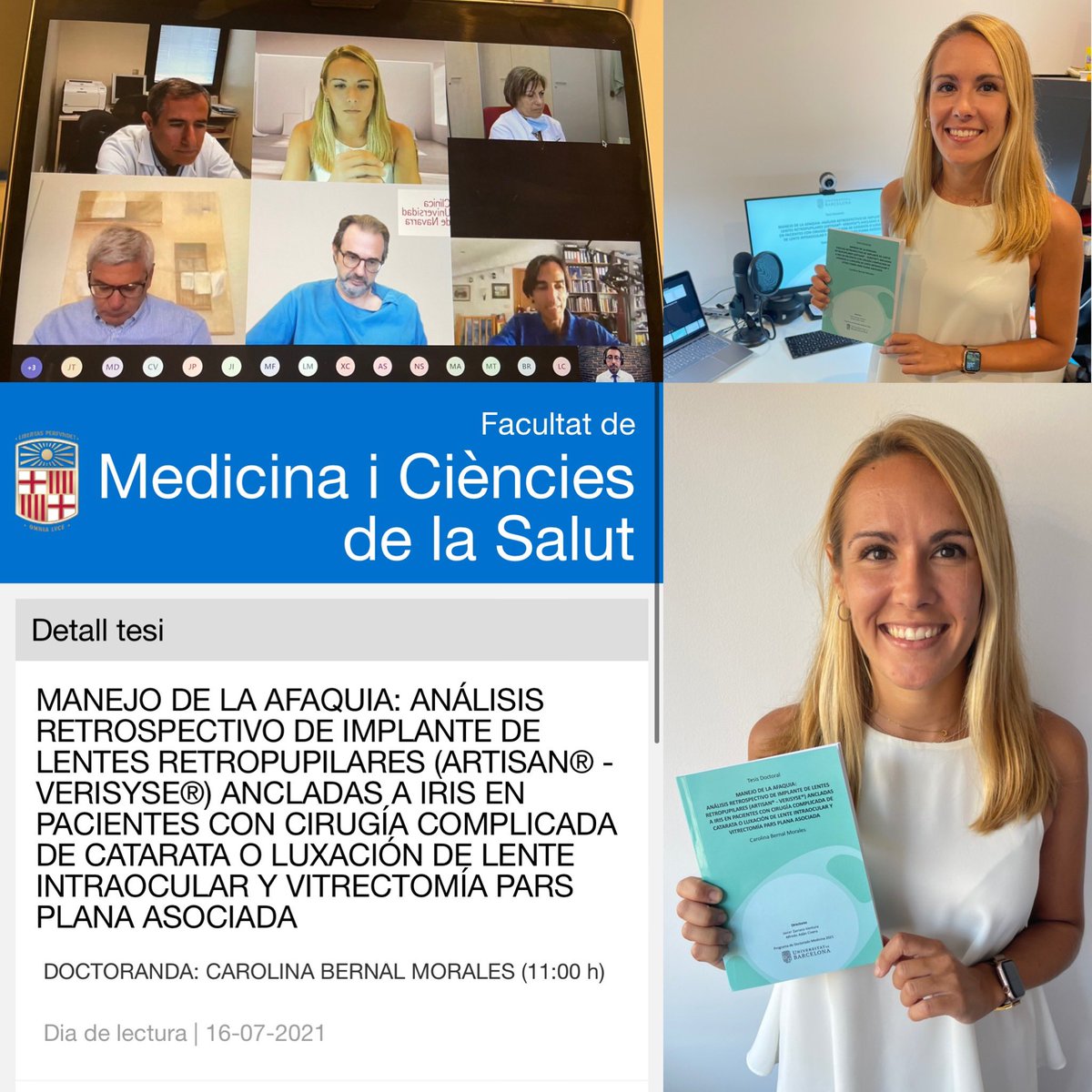 JavierZarranz's tweet photo. Tenemos nueva Doctora en el #ICOF del @hospitalclinic @idibaps @UniBarcelona : Enhorabuena @Carolmbernal!!!😎🙌 Un placer haber dirigido la #Tesis junto a @DrAlfredoAdan #VitreoRetinal #Surgery #Ophthalmology @RetinaSERV @Club_Esp_Macula @OftalmoSeo @barnaclinic @Clinica_Teknon https://t.co/eTnSvYFUHA