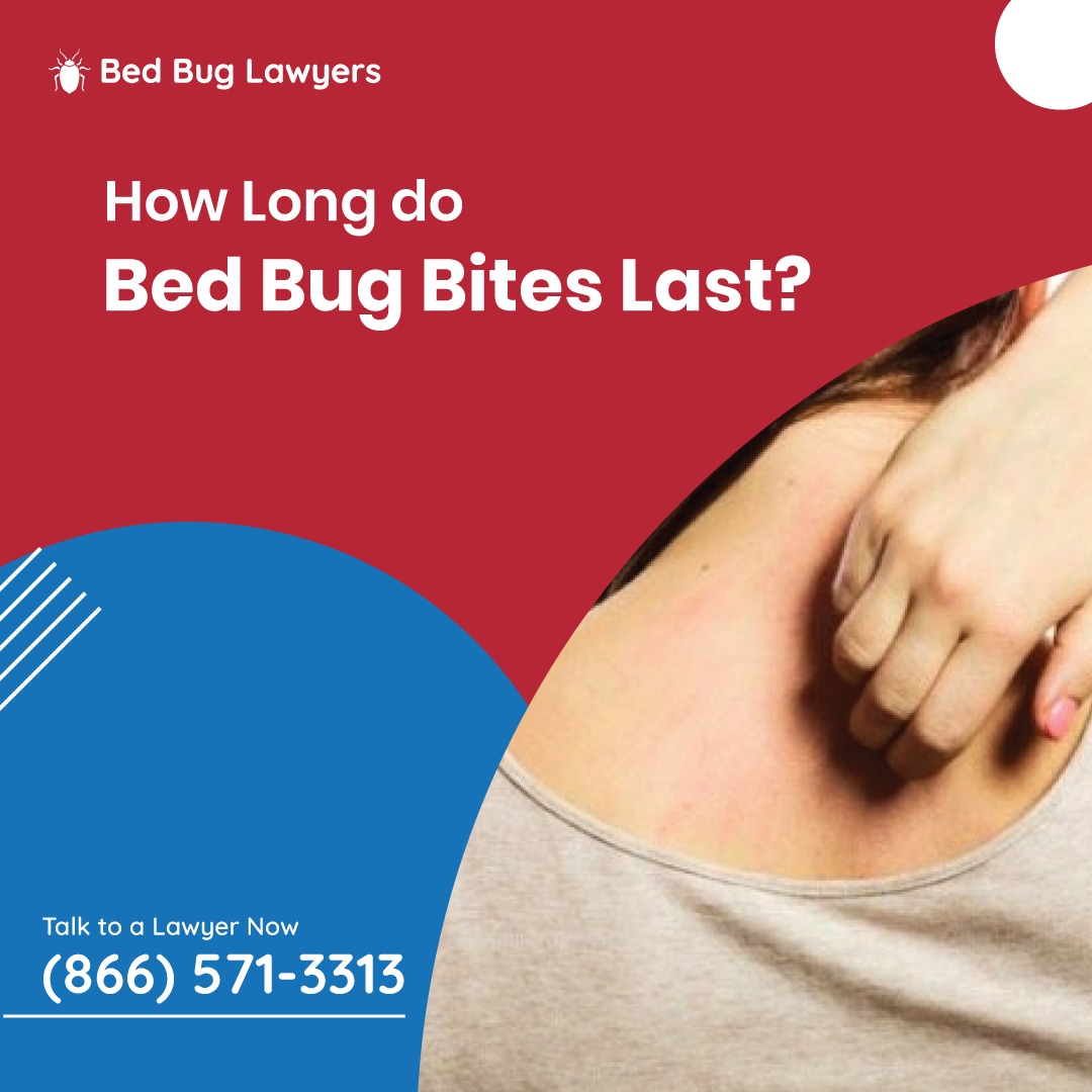 BedBugLawExpert's tweet photo. Bed bug bites can be irritating and incredibly itchy. Learn how long these bites will last on your skin. https://t.co/gzTU09dS2j

#bedbugs #bedbugtreatment https://t.co/pxJwwUXGgQ