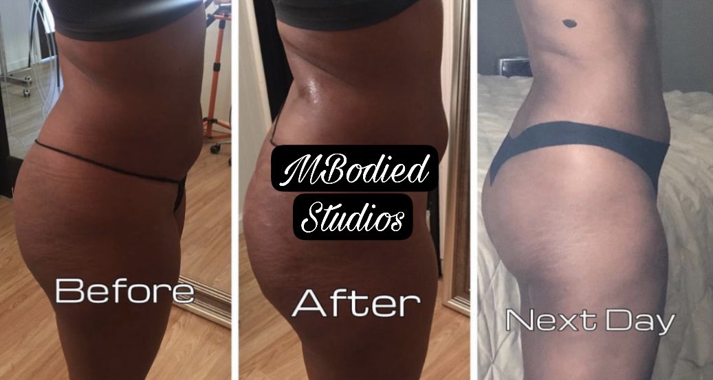 kaliworldd's tweet photo. Hii🤗 so I just recently started my Body Contouring business. I offer Laser Lipo, Vacuum therapy, RF skin tightening and more. I’m located in Atlanta. 

I'd really appreciate it if you guys retweet for exposure &amp; follow me on Instagram🥺 @MBodiedStudios Thank u in advance!💖💖 https://t.co/psnVdvs4Nd