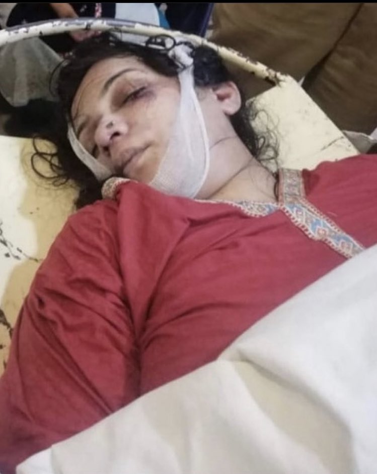 bizzleecos's tweet photo. This is what happens when problems like domestic violence gets ignored AND gets rejected by the goons of this country to have control over women. SPREAD THIS. #justiceforainy #JusticeForQuratulainAnnie https://t.co/bcDIwOrM4g