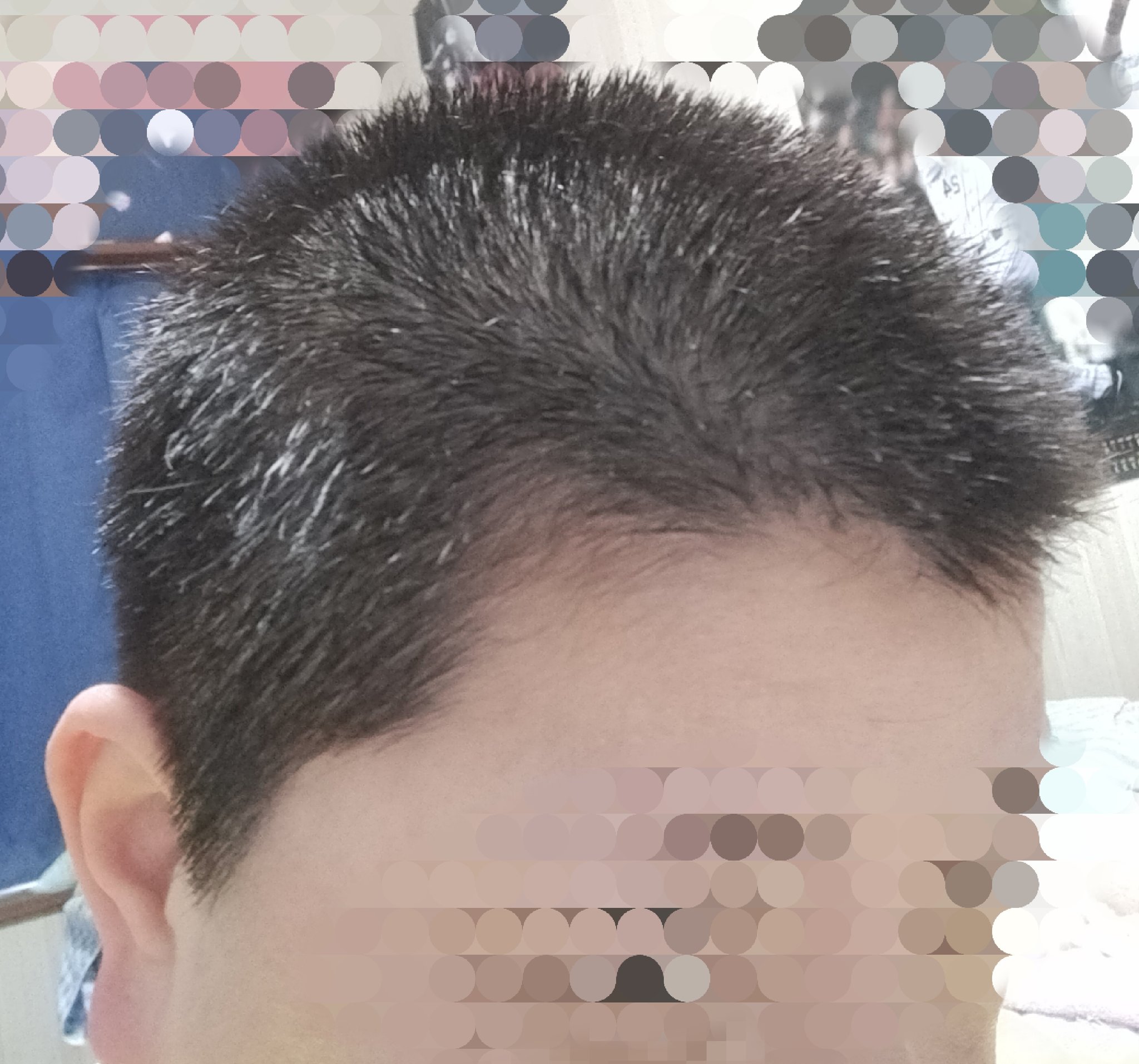すっぱい 坊主出来ました 上9ミリ 襟足6ミリでした 坊主女子 坊主 T Co 1kb7grb7d5 Twitter