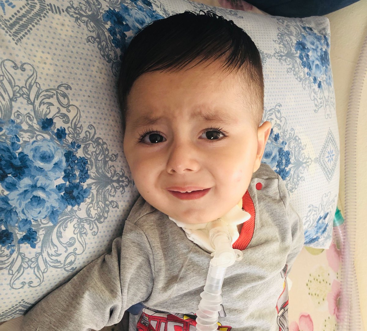 Yavrum gözlerimin önünde eriyor. Furkan çok fazla kas kaybediyor. Ne olur görün artık bizi. Hedefimiz için SON 40 GÜN! Furkan'ın her günü acıyla dolu. Dayanamıyoruz artık! Ne olur gücü yeten bağış yapsın. Gücü yetmeyen paylaşarak sesimizi duyursun
Büşra #Mokoko #ÜmitCanUygun Swap