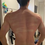 スプレーの日焼け止めは油断禁物。必ずスプレーした後に塗り込みましょう。