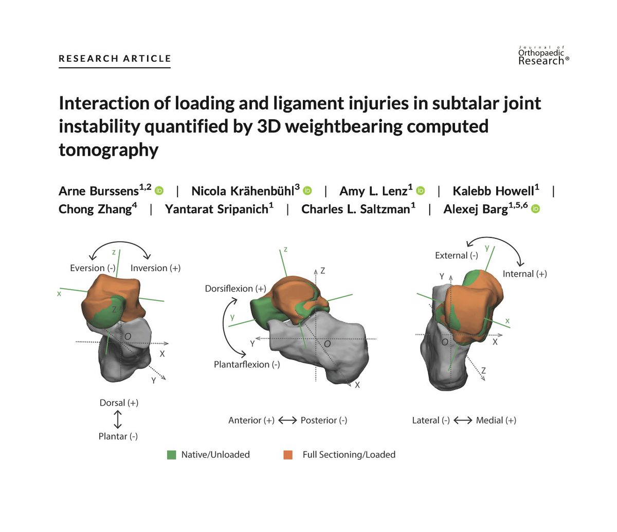 Arne Burssens (@a_burssens) on Twitter photo Hindfoot instability remains a diagnostic enigma in clinical practice - Our recent study published in #JOR implements weightbearing CT to detect several intriguing injury patterns: onlinelibrary.wiley.com/doi/full/10.10β¦ <a href="/ORSsociety/">Orthopaedic Research Society</a> <a href="/UofUOrtho/">UofU Department of Orthopeadics</a> @OrthoUZGent <a href="/wbctsociety/">International WBCT Society</a> Hindfoot instability remains a diagnostic enigma in clinical practice - Our recent study published in #JOR implements weightbearing CT to detect several intriguing injury patterns: onlinelibrary.wiley.com/doi/full/10.10β¦ <a href="/ORSsociety/">Orthopaedic Research Society</a> <a href="/UofUOrtho/">UofU Department of Orthopeadics</a> @OrthoUZGent <a href="/wbctsociety/">International WBCT Society</a>