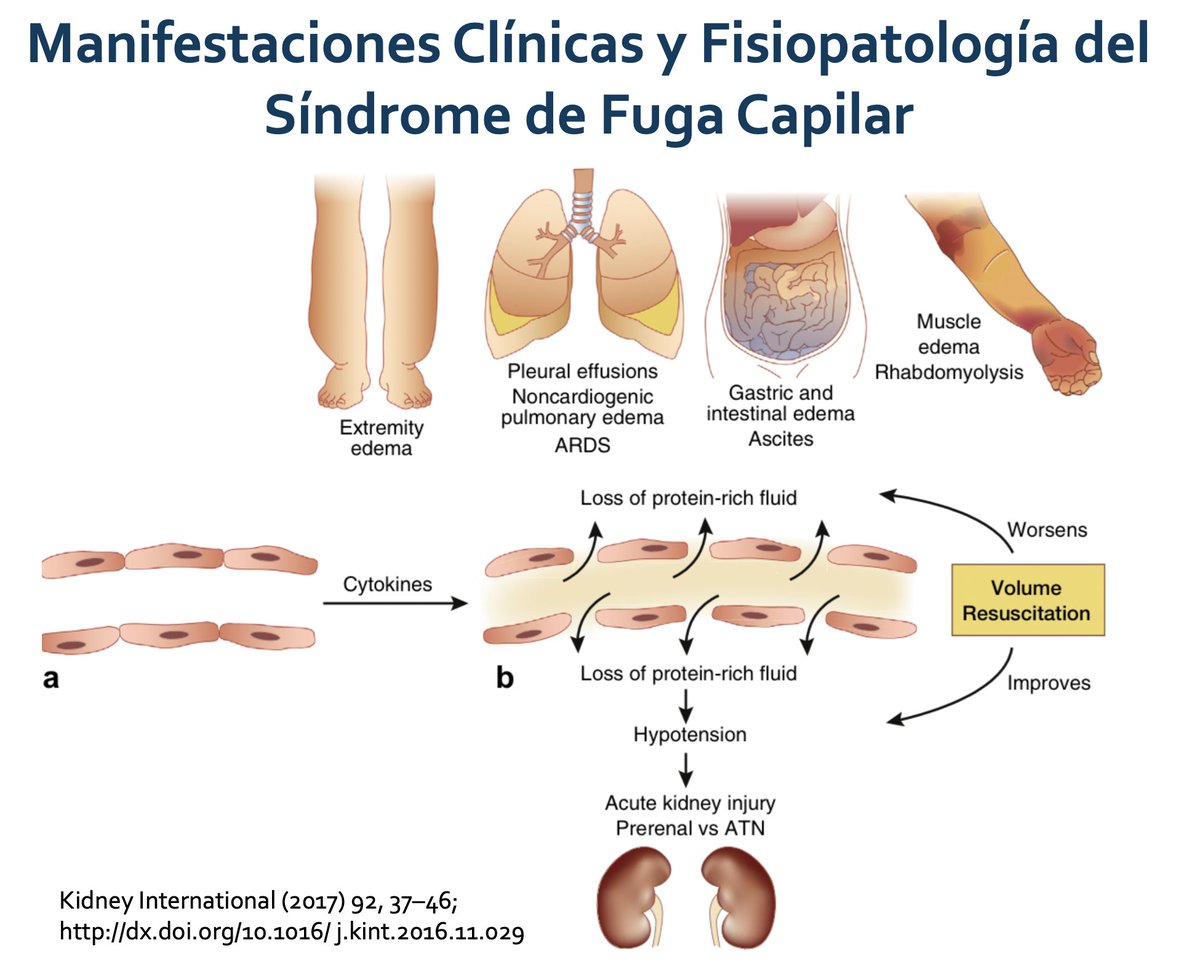 Fisiopatologia cetosis