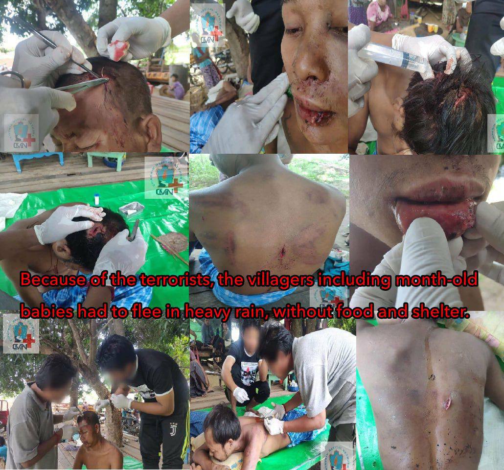 aom_april's tweet photo. 🏴 Military terrorists handcuffed and brutally killed about 15 refugees in Kani Tsp.  
Mines were also buried under the corpses, injuring the volunteers who come and collect dead bodies.
 
#KaniMassacre
#WhatsHappeningInMyanmar https://t.co/Hs6a4YUmT7