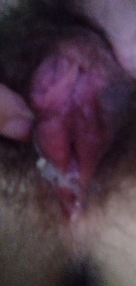 MaachaGoocha's tweet photo. @bluedralyamxd deleted nude https://t.co/j9GhN2RDls