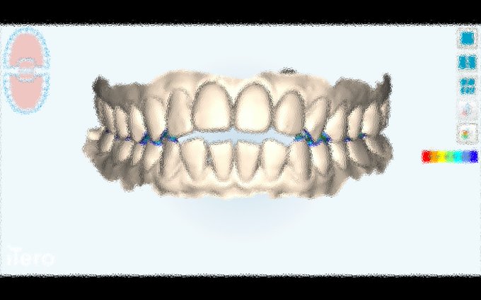 歯型のtwitterイラスト検索結果
