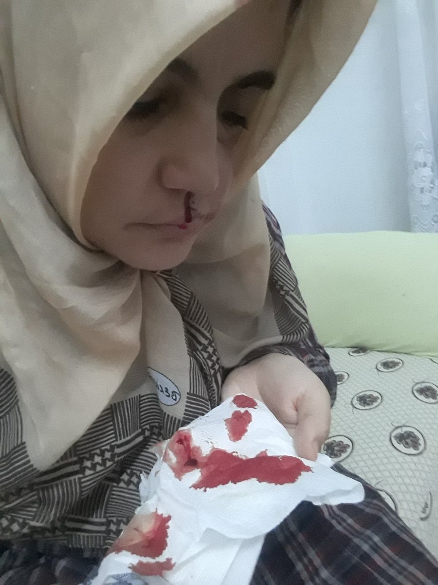 NataliAVAZYAN's tweet photo. "Cezam onaylandı.Kontrol,tedavi ve ilaçlarım aksadı.Yogun kanamalarım başladı." Ayşe Özdogan 

Kanser hastası hapse atılıyor 

Sosyal medyada uyuşturucu kullanan ,gencecik bir gencecik kızı öldürdüğü şüphelisi #UmutCanUygun  saliveriliyor https://t.co/pN47YDXTgW