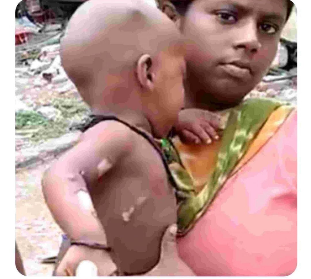 RamprakashVerma's tweet photo. लखनऊ में मजदूरों के अतिक्रमण हटाने के दौरान आरपीएफ दरोगा मोहित  ने जलते चूल्हे पर लात मारी जिससे कुकर में पक रही खौलती दाल दो मासूमों पर गिर पड़ी और वो छटपटाने लगे, इतना ही नहीं उन्हें तड़पता देख पुलिस का दिल नहीं पसीजा और मासूमों को छोड़ वे वहां से निकल गए ! #इंसानियतमरगयीं https://t.co/EI6t6hsfQQ