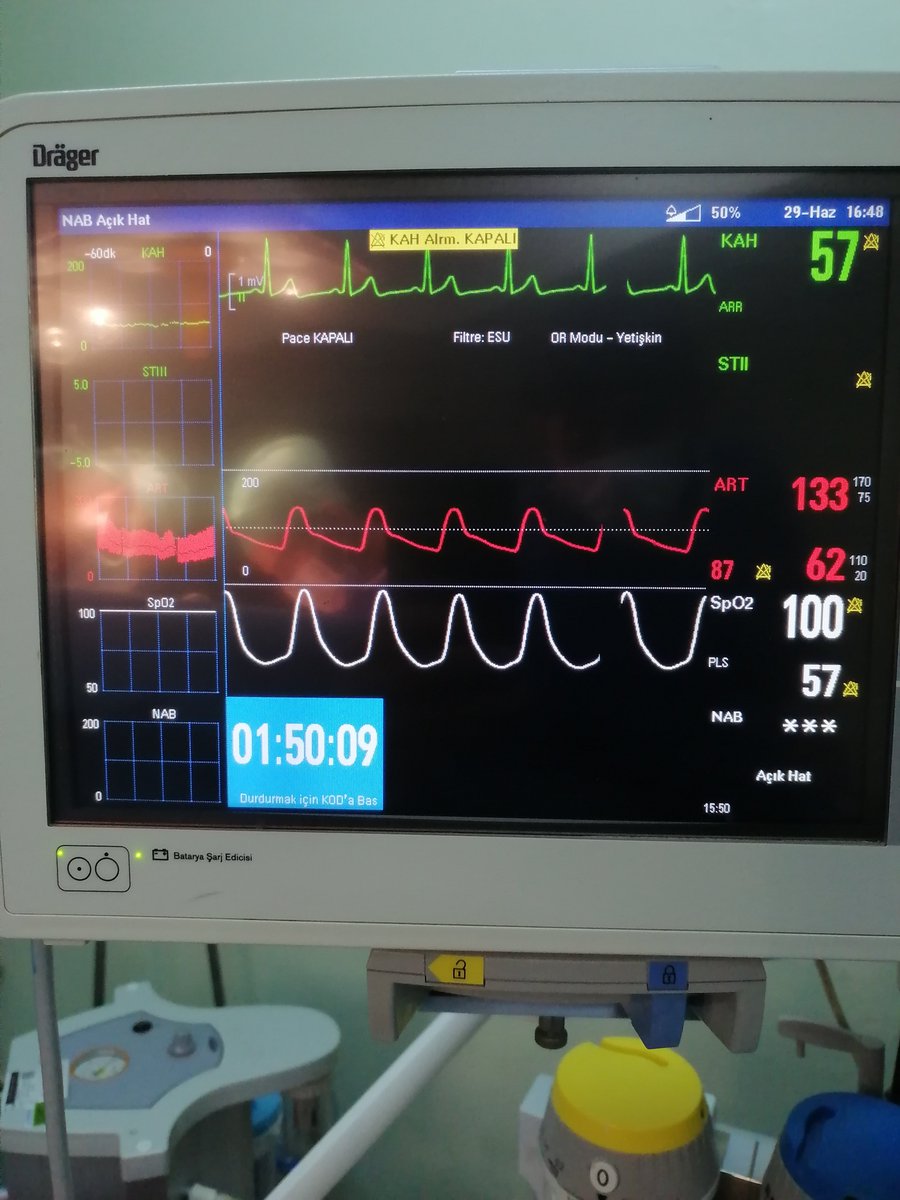48 yaş erkek hasta. Sağ kolon tümörü. Laparoskopik sağ hemikolektomi.operasyon süresi 1 saat 50 dk. Hasta postop 5. Gün problemsiz taburcu edildi.