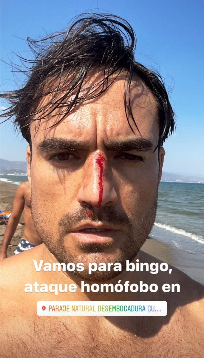 mordiskillo31's tweet photo. Vaya tela 🤦🏻‍♂️ https://t.co/4WoWmnJAAX