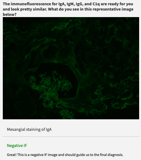 Neph_SIM's tweet photo. Case 18: A 40 y/o with rash & #RPGN 🌙
https://t.co/DOeCyO7HZP
#FOAMed #MedEd #KidneyPath #Nephrology https://t.co/L1lk66Q7ir