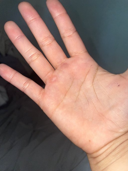 My hands looked      So my ass could like this:                          look like this: https://t.c