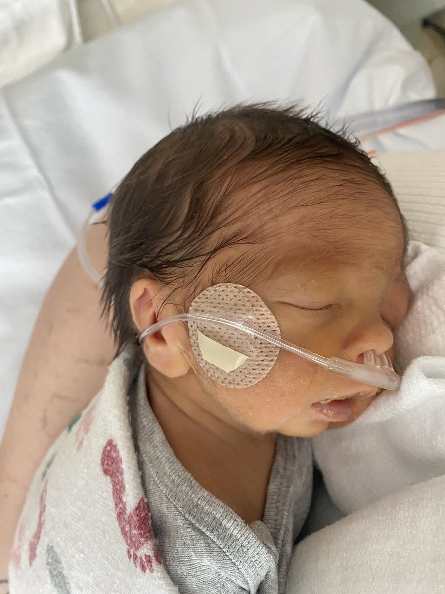 nd_queen22's tweet photo. My grandson is 30 weeks  3lbs 14 oz thanks god for Children Hospital Seattle  slowly getting stronger #permie https://t.co/6HoW6phWje