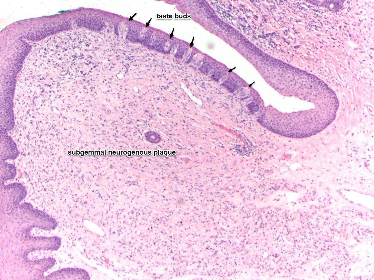 Tim Bracey tweet media