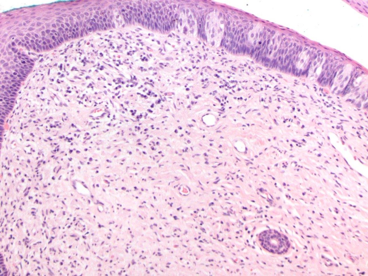 Tim Bracey tweet media