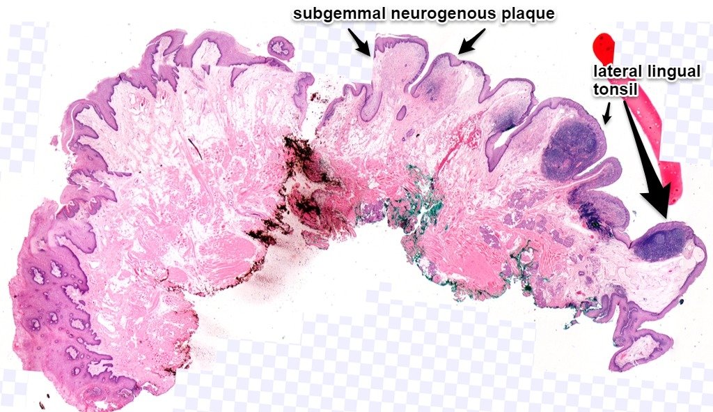Tim Bracey tweet media