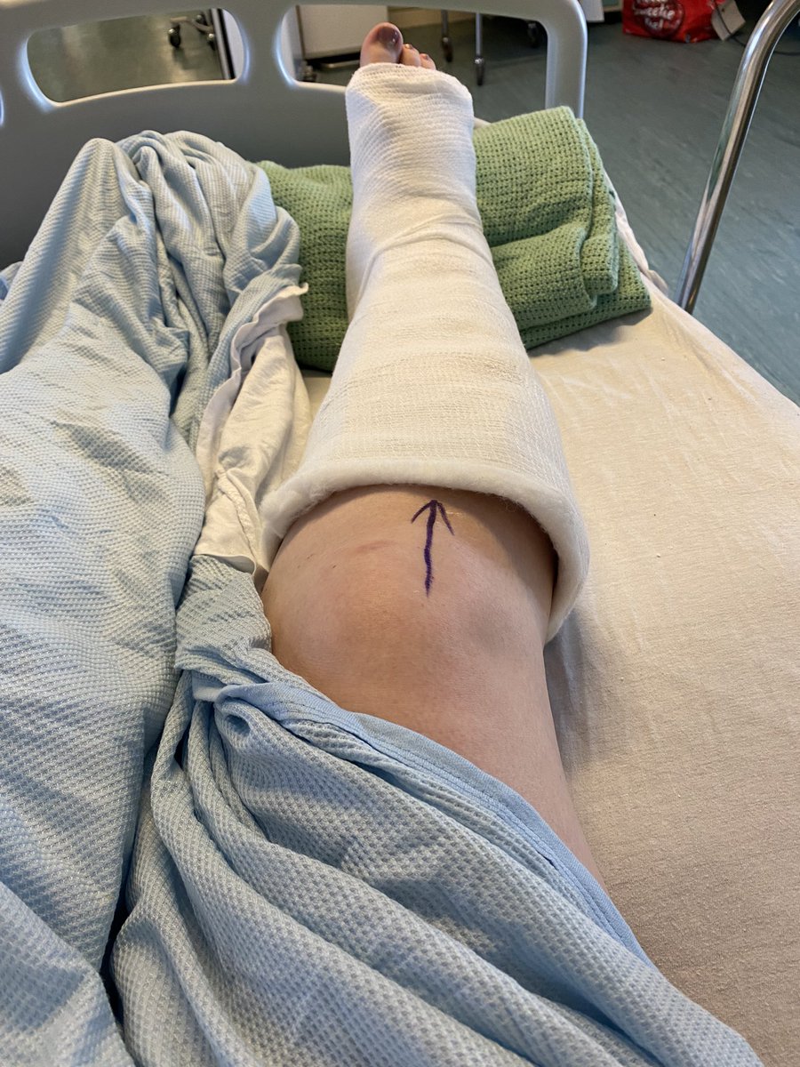 Stephwhit81's tweet photo. @Dominos_UK Fell over causing dislocated ankle and 5 breaks 💀 finally being released from hospital today so this would really cheer me up 🥺🍕🙂 #FreeDOMINOESday #pizzaisthemedicineineed https://t.co/zCFapJrKaj