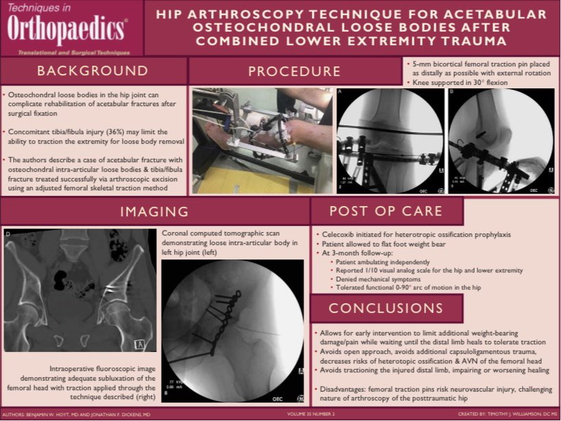 Our latest #VisualAbstract is out! "Hip Arthroscopy Technique For Acetabular Osteochondral Loose Bodies After Combined Lower Extremity Trauma"

#Orthopedics #orthotwitter #orthopaedics #orthopedicsurgery