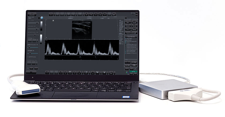Telemed15's tweet photo. The software upgrade  transforms black-and-white MicrUs into portable Doppler system. Please contact us if you are interesting in this upgrade. https://t.co/j61HBeoGOM https://t.co/QboaKoPyJv