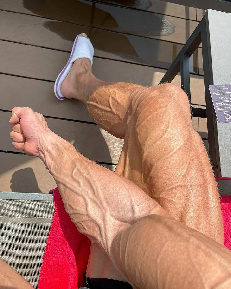 SyntholanTech's tweet image. Too veiny: 1,2,3,4 or 5 ?!👇🏻👇🏻👇🏻

#ripped #sixpack #exercises #circuittraining #coreworkout #workouts #fitnessmodel #absaremadeinthekitchen #veins #veinspoppin