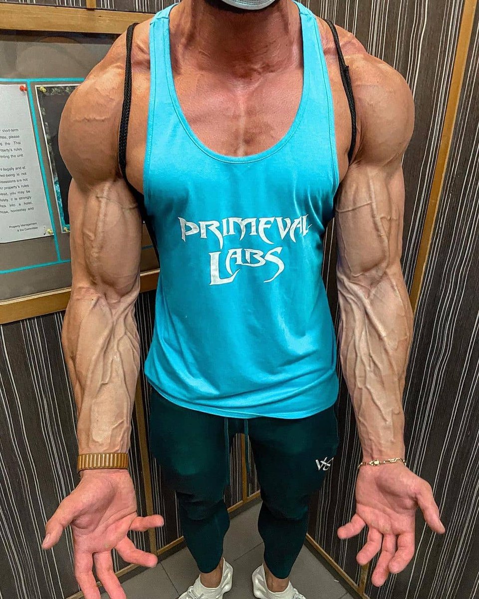 SyntholanTech's tweet image. Too veiny: 1,2,3,4 or 5 ?!👇🏻👇🏻👇🏻

#ripped #sixpack #exercises #circuittraining #coreworkout #workouts #fitnessmodel #absaremadeinthekitchen #veins #veinspoppin