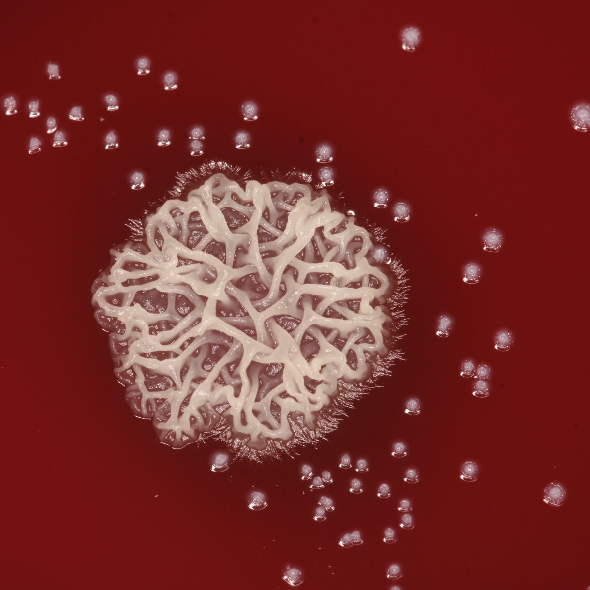 EastmanDental's tweet photo. Look at these magnificent colonies yeast and Streptococcus mutans form! @JinXiaoPhD and her EIOH #URochesterResearch team has found collaborative work between yeast and #bacteria that cause tooth decay. Read more in @JDentRes https://t.co/VZ6tMXQvsm https://t.co/WqYTuEENOI