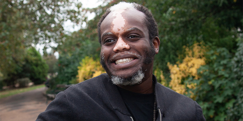 See if you qualify for a vitiligo treatment study! A research study is testing an investigational device for a potential treatment of stable vitiligo (no change in the past 12 months). Learn more about this study and see if you qualify: bit.ly/3g9rEJ6
#paidadvertisement