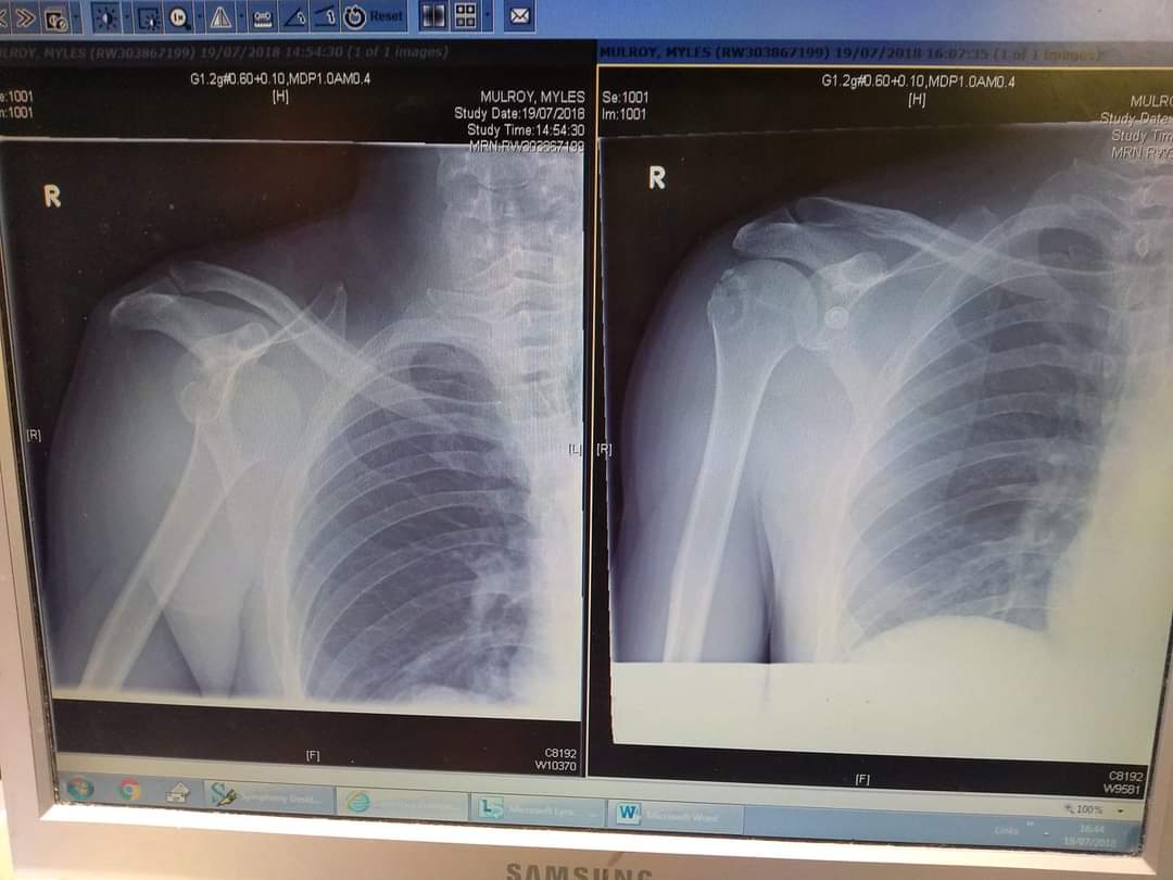 SciTechMEAC's tweet image. Was far too busy doing Technician Stuff™ too take part in Sports Day last week. Then today Facebook reminded me of what happens when I try to get sporty...