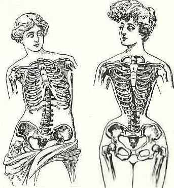 WikiVictorian on X: Dress reformers argued that women's bodies