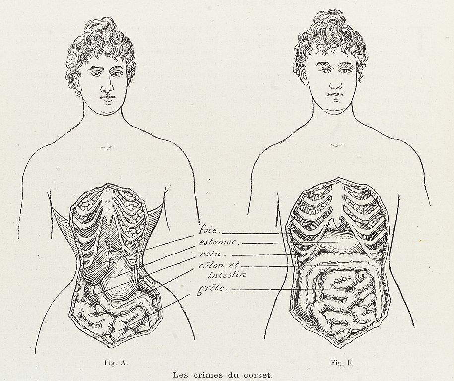 WikiVictorian on X: Dress reformers argued that women's bodies