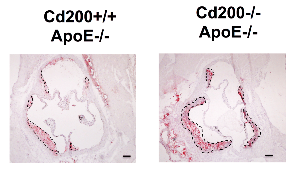 CircRes's tweet photo. Kassiteridi, et al. show #CD200 acts at the #vascular & #myeloid level to limit #monocyte-#macrophage recruitment, lesion growth & #hypercholesterolemia driven dysregulated #monopoiesis https://t.co/ujKYrpWcdK
@LabMonaco @SempreRossa @anushans @pattarabanjird https://t.co/W1lpxWroGk