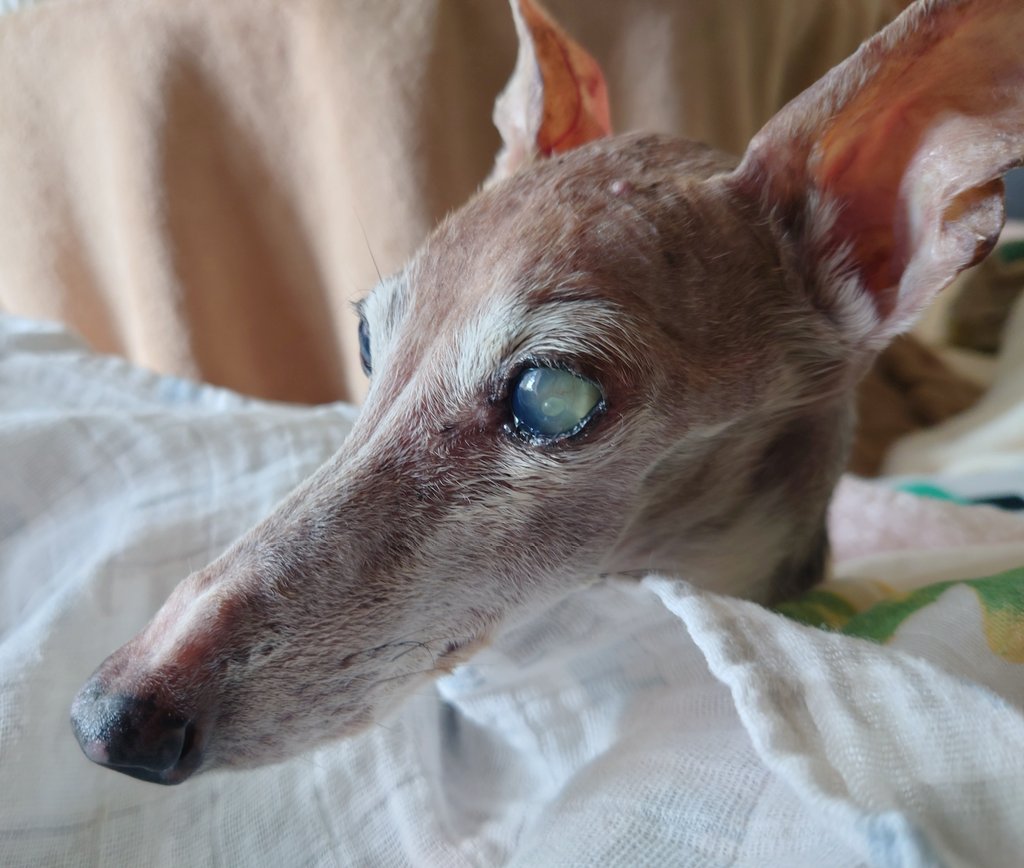 転移性脳腫瘍 Twitter Search