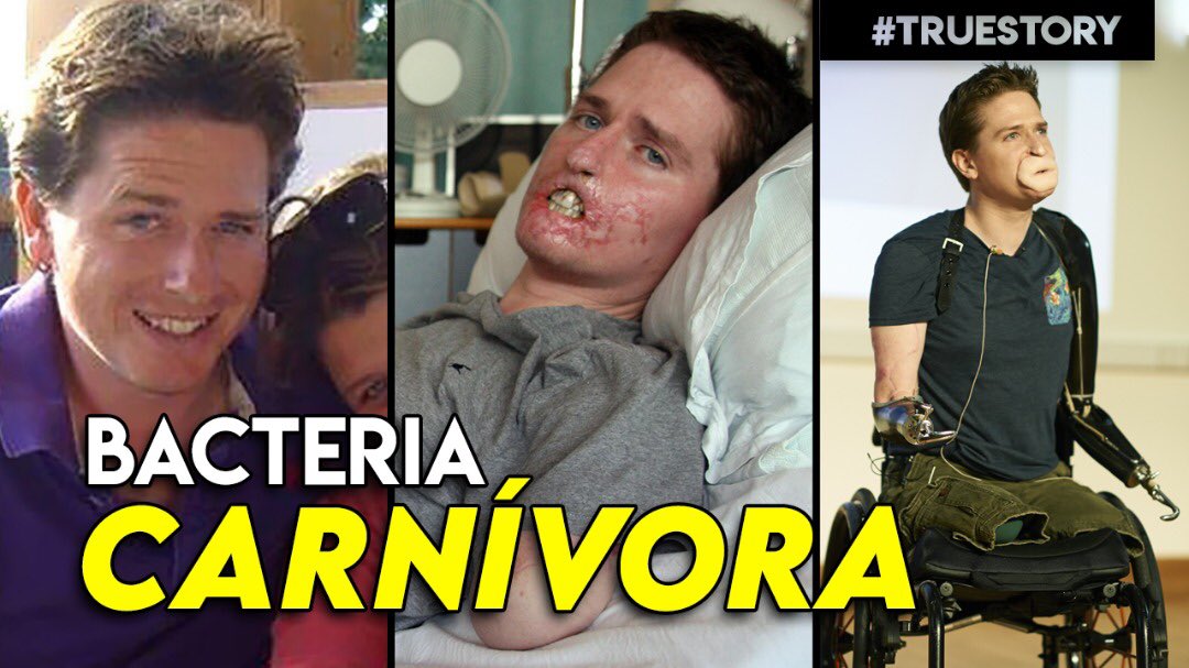 ¿Ya conociste el extraño caso de Alex Lewis? ⚠️ bit.ly/36OxHxw No te lo puedes perder!!! #SomosOWYKA #YKA #TLTOWYKA #TLROWYKA #notelopierdas #curiosidades #Youtube #datoscuriosos