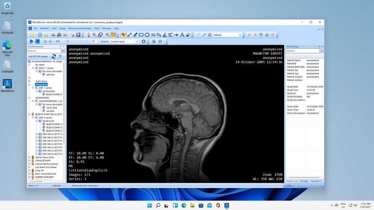 mri viewer mac mri viewer mac