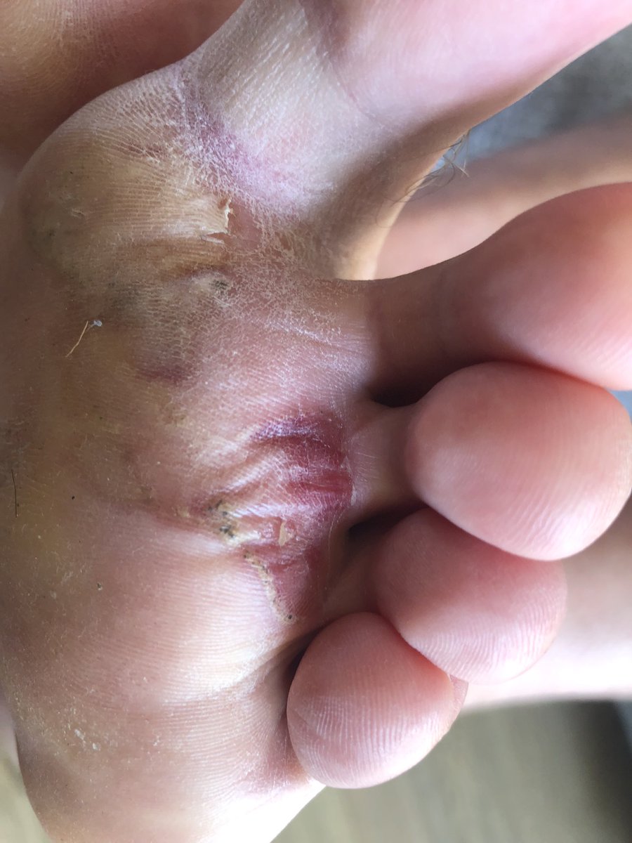 Jon Parkin tweet media