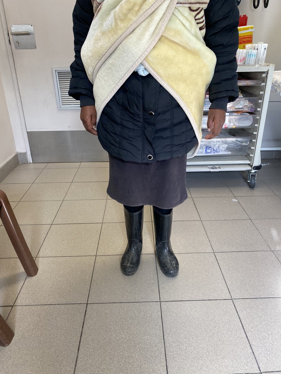 ningiza_sive's tweet photo. Hi all. Can we please help out this lady. 

She and the baby are my regular patients to an extent where she feels comfortable telling me her personal deep matters. 

She’s 22 years old and has a 9/12 old baby. She’s unemployed and is struggling in all aspects. https://t.co/q1zEKktaFx