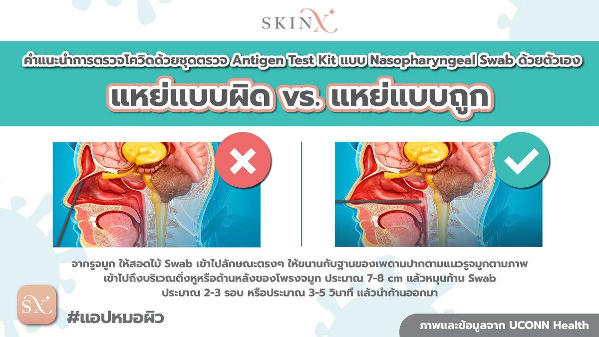 SkinX #แอปหมอผิว tweet media